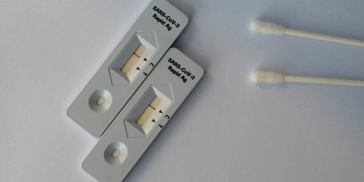 Un estudio de FACUA revela que sólo el 3% de farmacias tienen test de antígenos 1 test antigenos covid-19