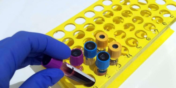 Situación insostenible en los laboratorios clínicos de los centros sanitarios de Andalucía por la aparición de ómicron 1 Situación insostenible en los laboratorios clínicos de los centros sanitarios de Andalucía por la aparición de ómicron