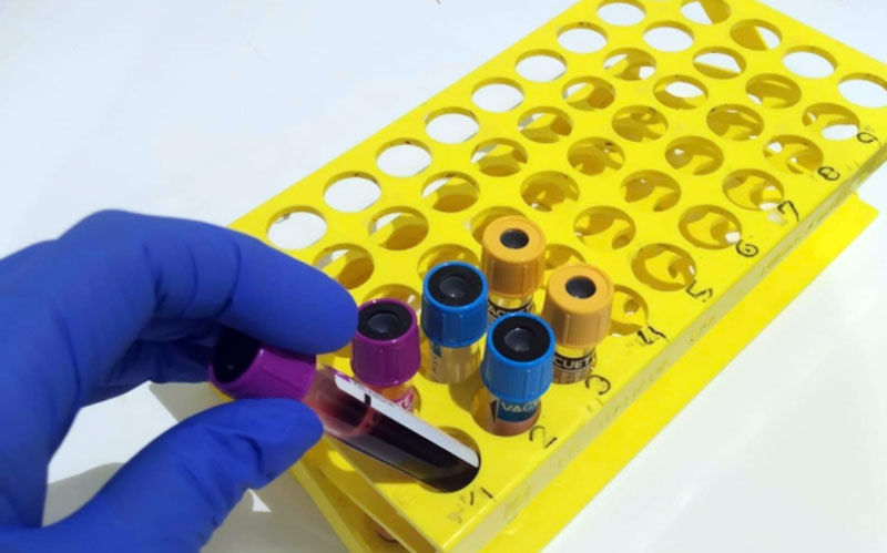 Situación insostenible en los laboratorios clínicos de los centros sanitarios de Andalucía por la aparición de ómicron