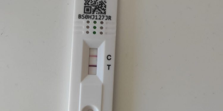 Imagen de un test de antígenos positivo en COVID-19