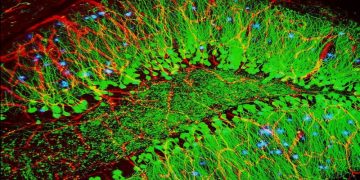 cerebro ratones alzheimer