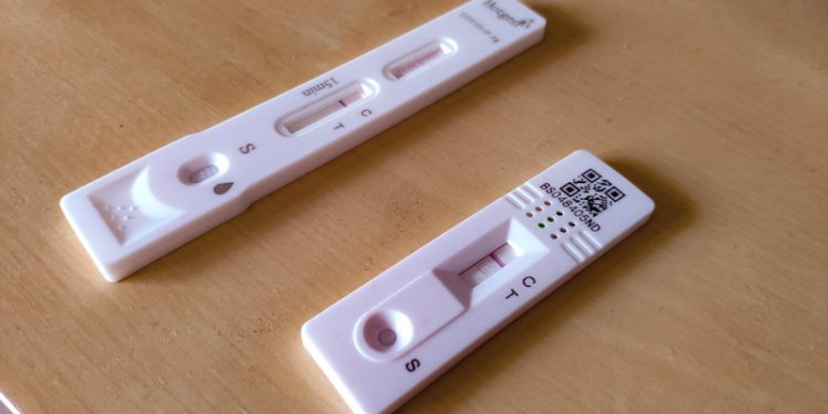 Las cifras de Covid-19 vuelven a repuntar en Andalucía 1 Test Covid